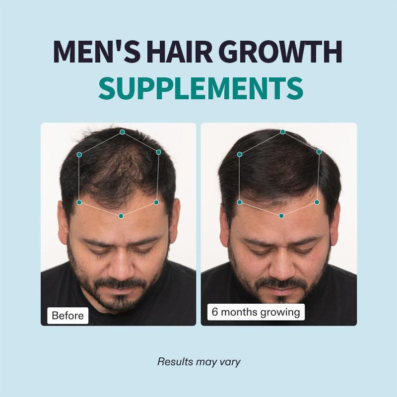 OEM Suplementos de crescimento do cabelo masculino visível mais espesso cabelo e cobertura do couro cabeludo Capsulas de cabelo masculino