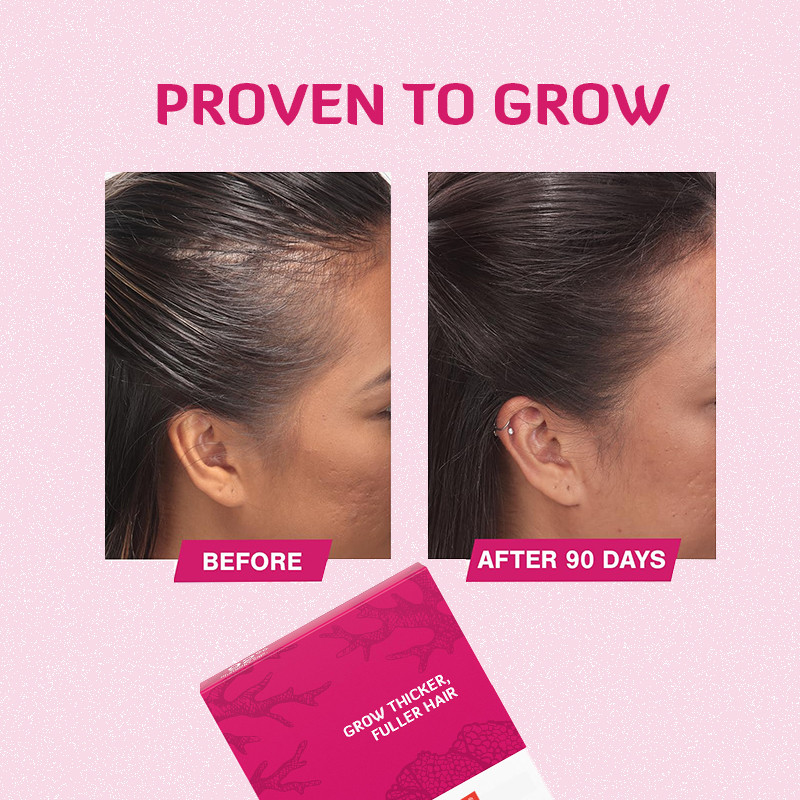 Comprimidos de crescimento do cabelo 120mcg Biotina Produto de crescimento do cabelo para crescimento do cabelo