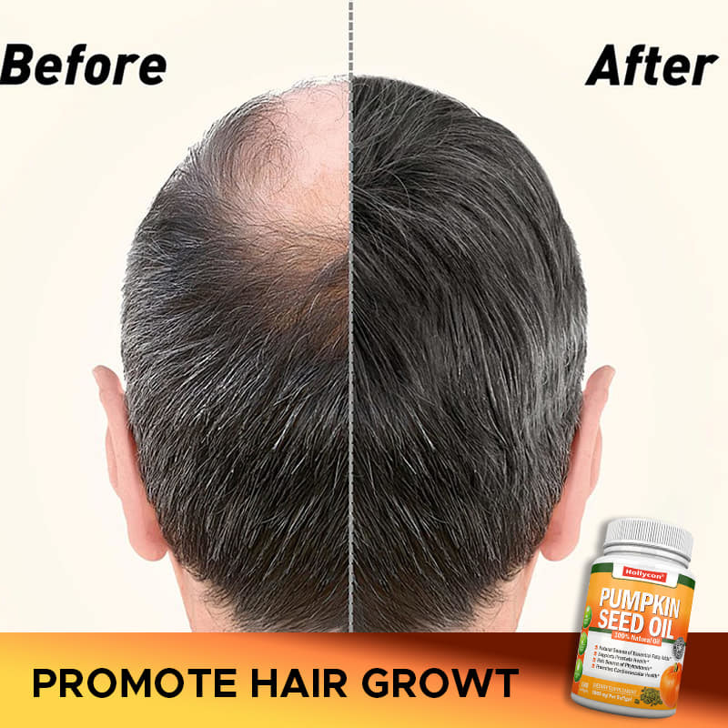 Óleo de sementes de abóbora de fábrica Softgels cabelo próstata saúde das articulações ômega-3 ácido graxo essencial suplemento