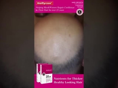 Comprimidos para crescimento de cabelo vermelho