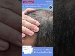 Crescimento do cabelo